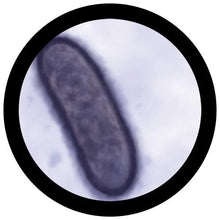 Load image into Gallery viewer, the black death - microscopic view